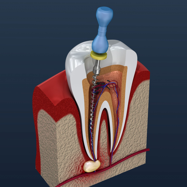 General Dentistry - Ace Dental London W1
