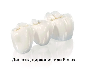 Установка керамической коронки