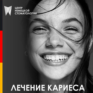 Лечение зубов под микроскопом 