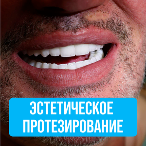 Эстетическое протезирование
