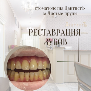 Художественная реставрация ENAMEL PLUS