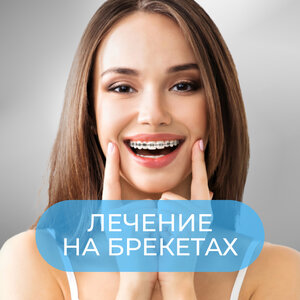 Лечение на металлических брекетах