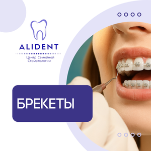Брекеты от