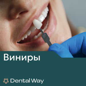 Виниры