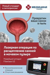 Дробление камней в мочевом пузыре.Махачкала.Новый лазер.