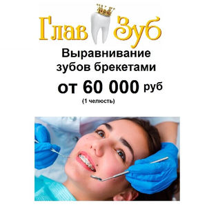 Ортодонтическое лечение брекетами