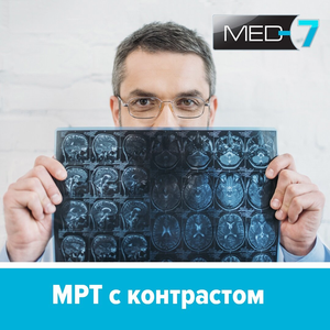 МРТ ангиография сосудов