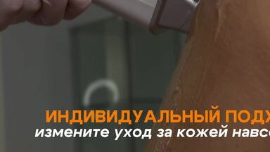 Лазерная эпиляция