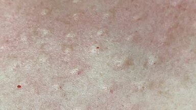 Мезотерапия от 5 т р лицензионные препараты