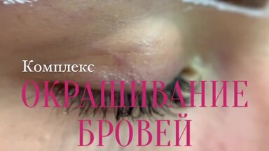 Окрашивание