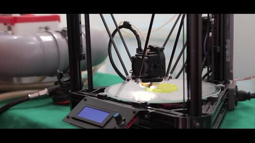 Men kokraklarni kora olaman