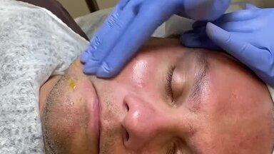 ALUS PEEL от GIGI  это:  Комбинация из 6 кислот! Азелаиновая, Молочная, Ундециленовая, Салициловая, Трехлоруксусная и Ретиноевая.
