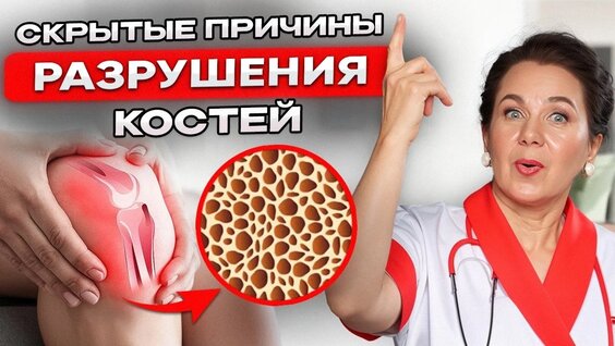 Остеопороз: Как не рассыпаться после 45 лет? Причины, симптомы и методы укрепления костей — Вид...