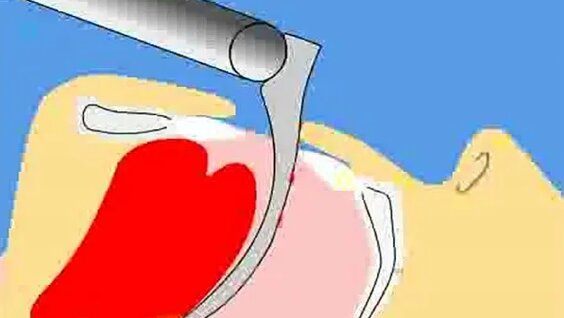 Onlayn porno anal jinsiy aloqa