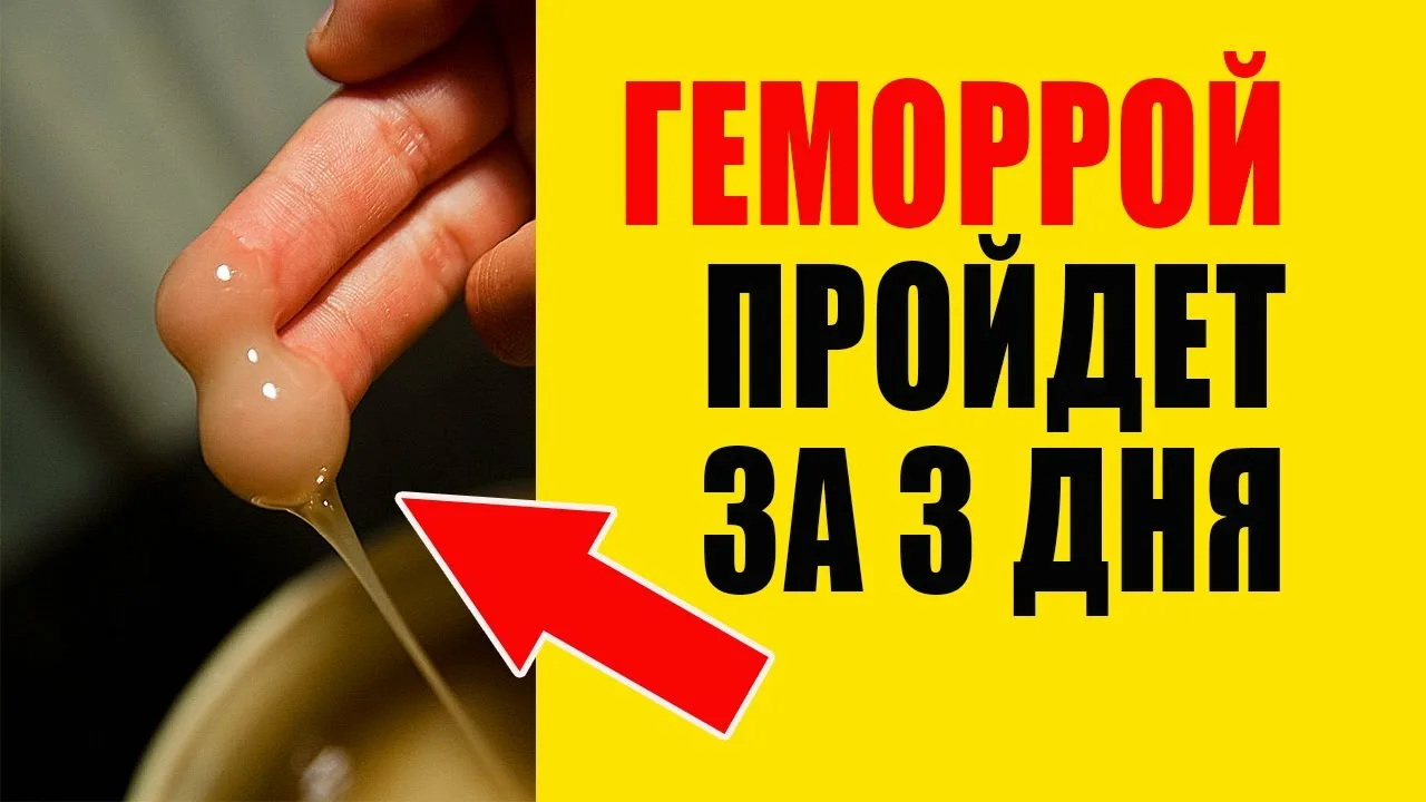 Лечение Геморроя В Домашних Условиях Без Лекарств