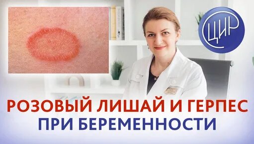 Дөңес киска фотосы