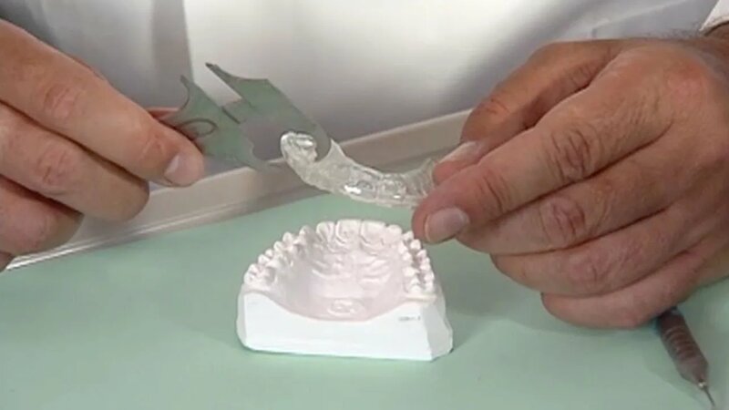 Слушать Simple Splint Therapy Utilizing Hard Soft Occlusal Splints mp3 ...