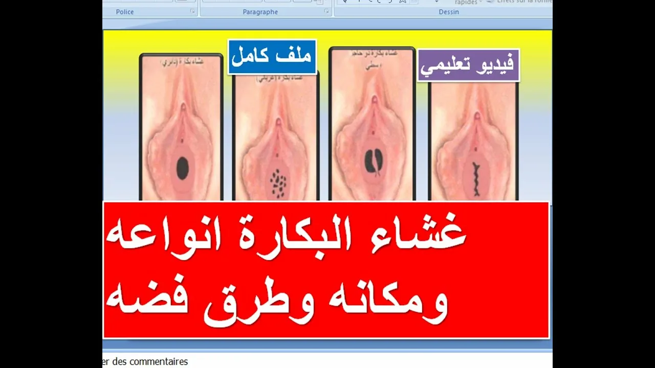غشاء البكارة انواعه ومكانه وطرق فضه