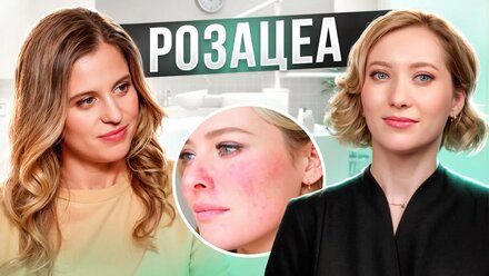 РОЗАЦЕА | КРАСНЫЕ ЩЁКИ | ПОКРАСНЕНИЯ НА ЛИЦЕ | О ПРОБЛЕМАХ КОЖИ С КСЕНИЕЙ АФОНИНОЙ | NEW WAY CLINIC