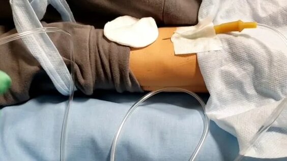 Проктолог орыс қызына клизма жасайды.