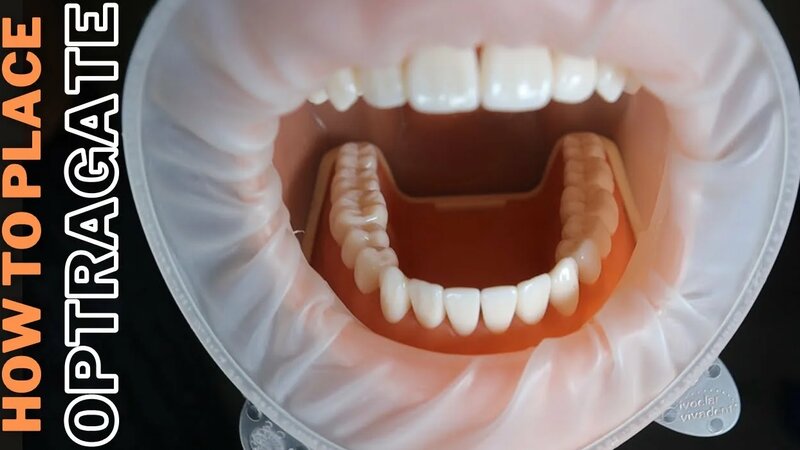 Optragate and My Notorious Dummy Patient 🟢 How To Place Optragate and ...