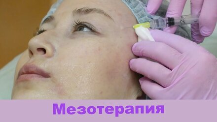 МЕЗОТЕРАПИЯ Йошкар-Ола. Косметолог Йошкар-Ола