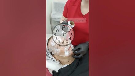 Мезотерапия лица в Краснодаре #уходзакожей #морщины #beauty #косметология #акне #омоложениелица