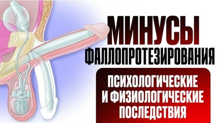 Минусы фаллопротезирования, психологические и физические последствия