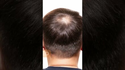 SEVICH пудра для придания густоты волосам #hair #волосы #лысый #загуститель #sevich #волос #shorts