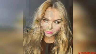 стефания маликова до и после пластики фото — Yandex: 1 milyon ...