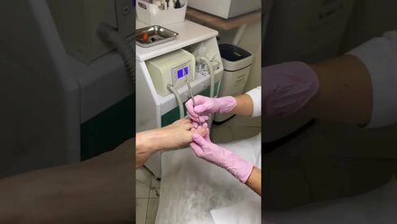 Педикюр у подолога