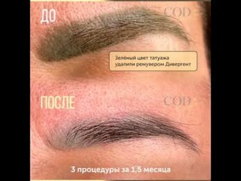 Поговорим об Умном ремувере и ремувергент Дивергент