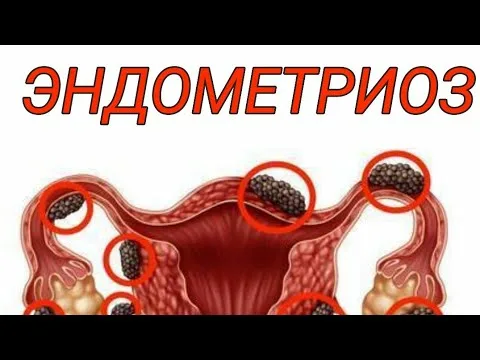 Выкса қаласындағы жезөкшелер