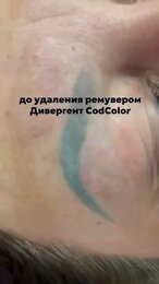 Ремувер удаление ПМ до и после #обучениеремувер #permanentmakeup