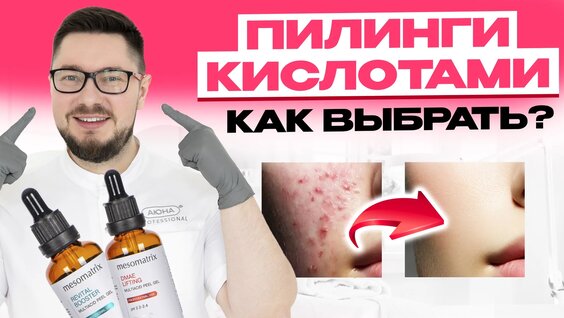 Лучшие кислоты для лица / 10 ксилот для пилингов — Видео от АЮНА: косметика Mesomatrix