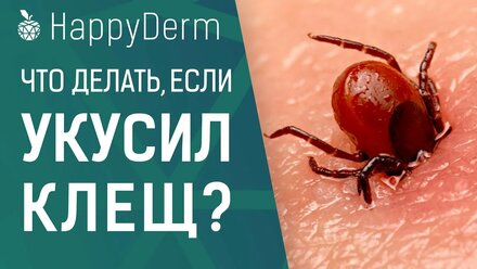 КАК ДОСТАТЬ КЛЕЩА САМОСТОЯТЕЛЬНО, ЛУЧШЕЕ СРЕДСТВО ПРОТИВ КЛЕЩЕЙ, ПРО ЭНЦЕФАЛИТ И БОРРЕЛИОЗ