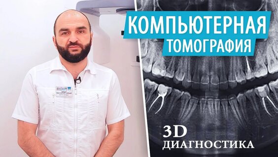 Компьютерная томография зубов (КТ). 3D Диагностика. Рентген зубов — Видео от Клиника Р...