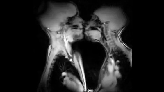 Yana Xelen Xantning porno surati qotib qoldi