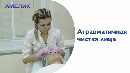 ЧИСТКА ЛИЦА Йошкар-Ола. Чистка лица отзывы.