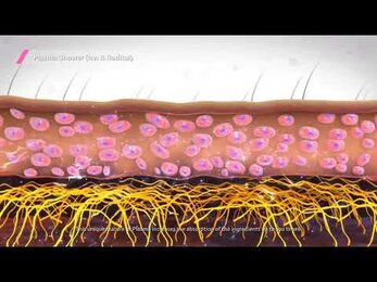 Механизм действия насадок Plasma BT и Plasma душ