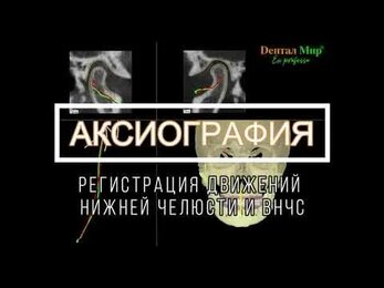 АКСИОГРАФИЯ - новейшая технология регистрации движений нижней челюсти и ВНЧС при их дисфункции.