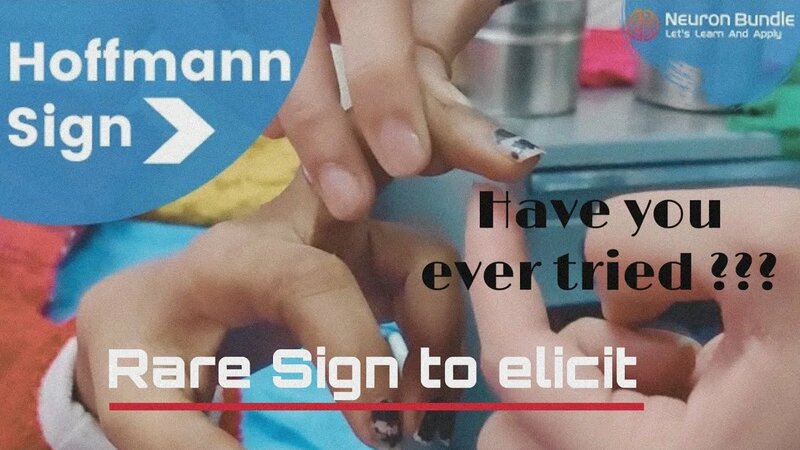 Hoffman’s Test or Trömner's reflex : upper limb babinski sign #positive ...