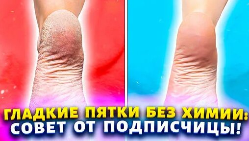 Судағы порно фото