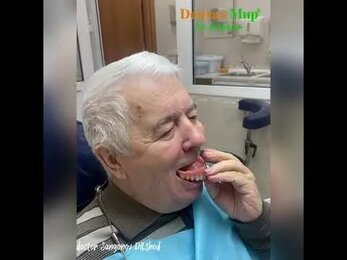 Как должен фиксироваться полный съемный зубной протез? Видео отзыв пациента.
