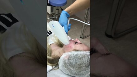 VENUS VIVA проведение процедуры