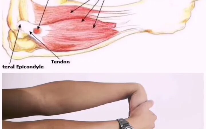 Forearm extensor stretching - Yandex Video aramada çevrimiçi izle