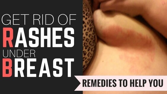 How To Get Rid Of Dry Skin Under Breasts 