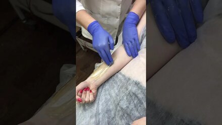 Сахарная депиляция