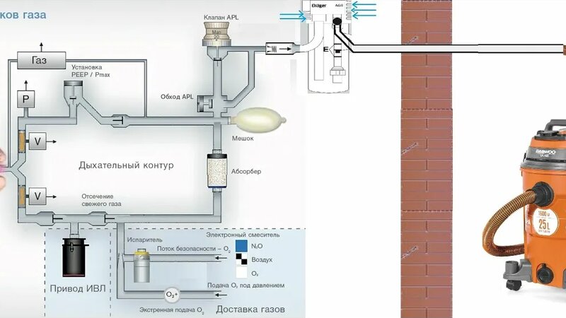 AGSS система удаления анестезирующих газов - Смотреть онлайн в поиске ...