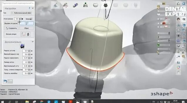 Основы моделирования в 3shape - Смотреть онлайн в поиске Яндекса по Видео